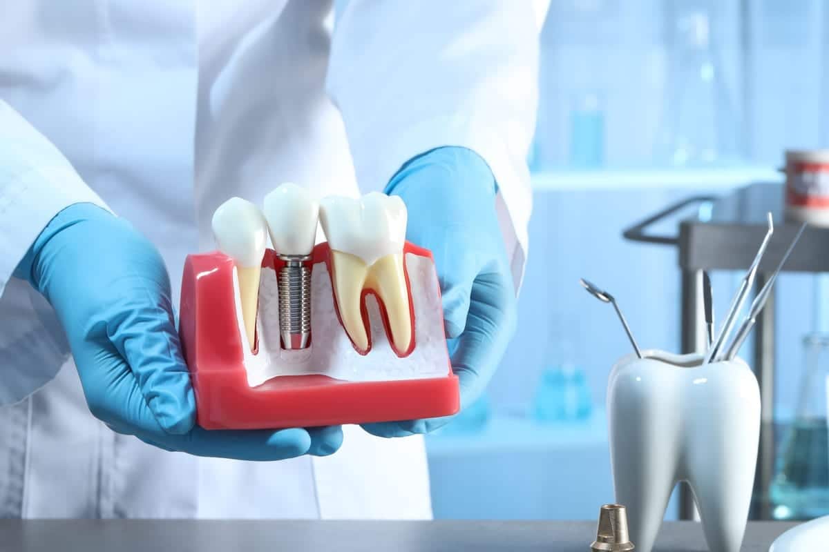 Dental Implants in Ripon